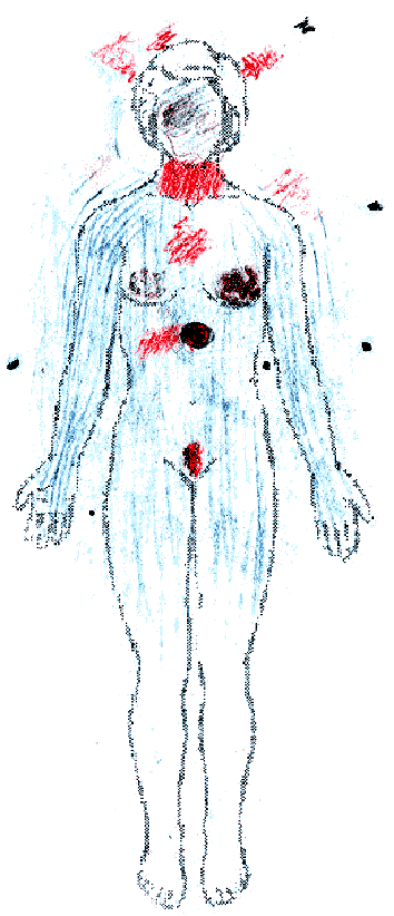 ris2