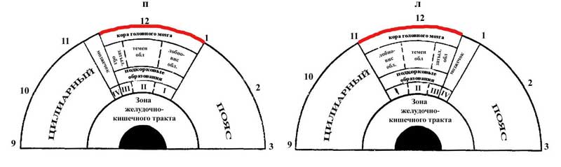 ris2