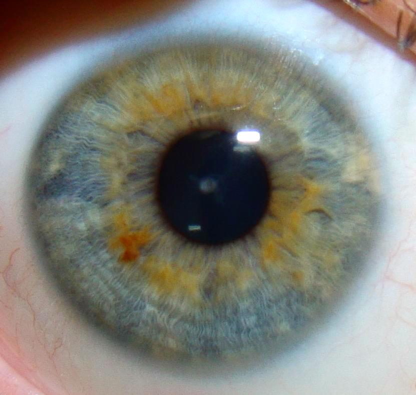 ris40